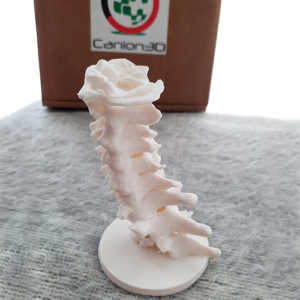 Canion3D Cervical Spine PLA Front Left