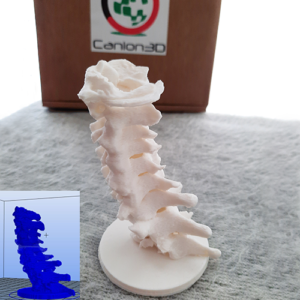 Canion3D Cervical Spine PLA Front Left 2