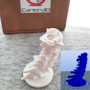 Canion3D Cervical Spine PLA Top Right 2