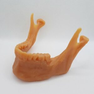 Print jawline resin right side